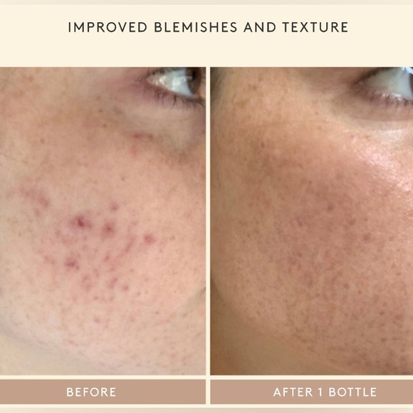 ๐2/$28 or 3/$38๐ Shani Darden Retinol Reform - Picture 7 of 8